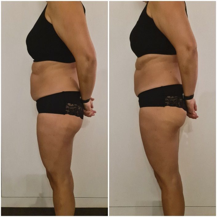Voorbeeldresultaat BodySculpting PRO 6: voor en na