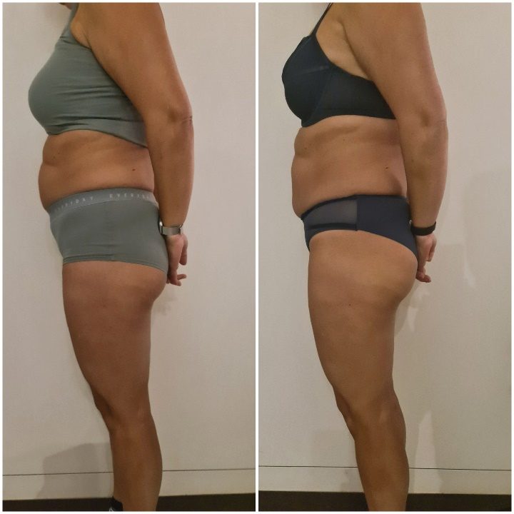 Voorbeeldresultaat BodySculpting PRO 7: voor en na