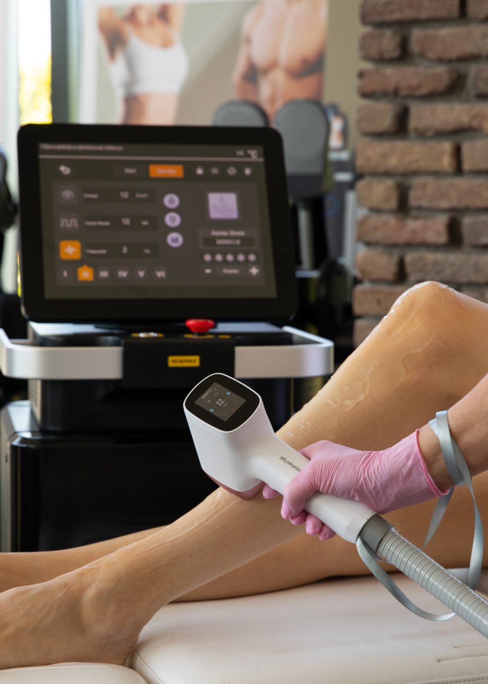 Gladde benen zonder dagelijks scheren? Plan jouw intake en ontdek of laserontharen bij je past.