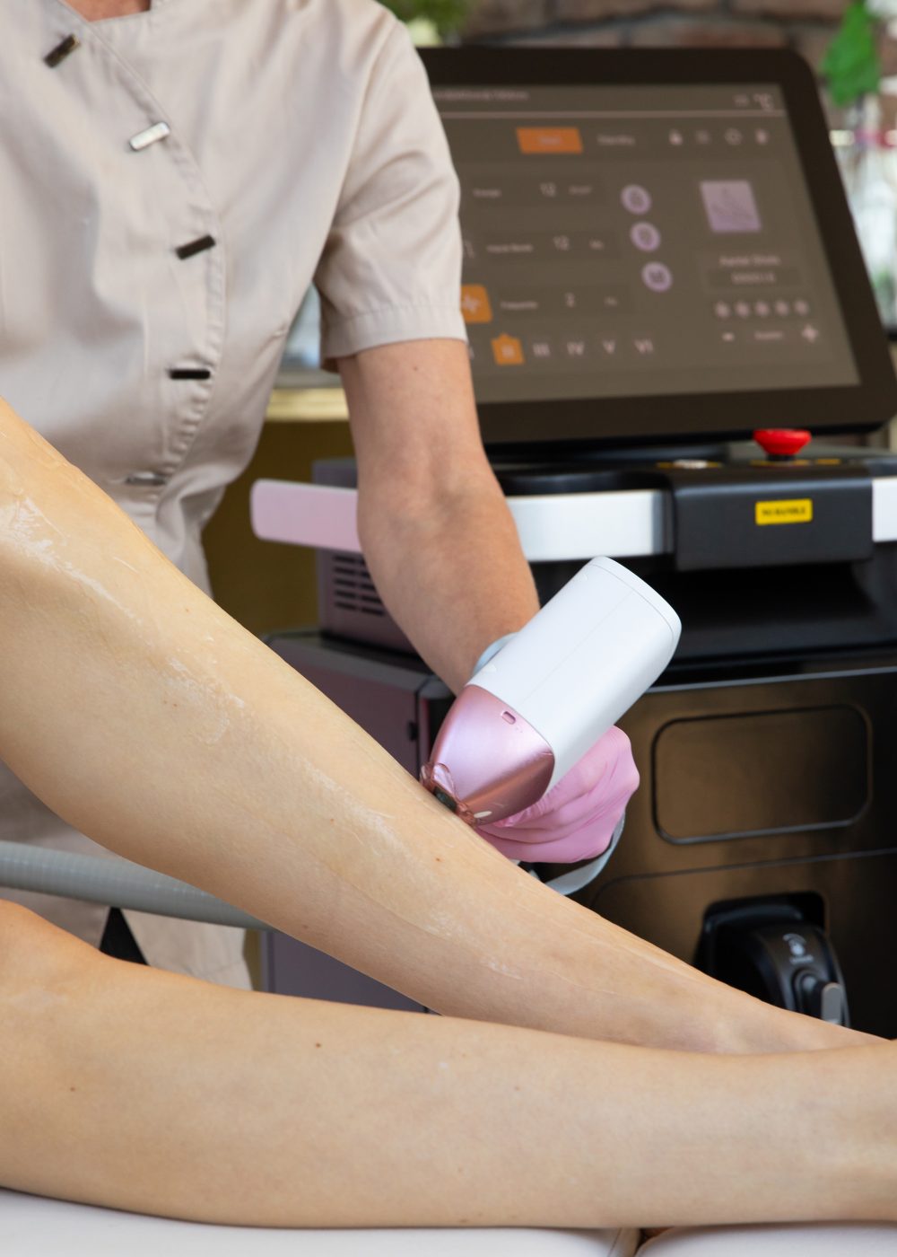 Diode laserontharing van de benen met de Diode ICE 4-Wave Master